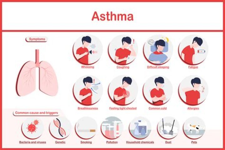 Are people with allergies more likely to have asthma?
