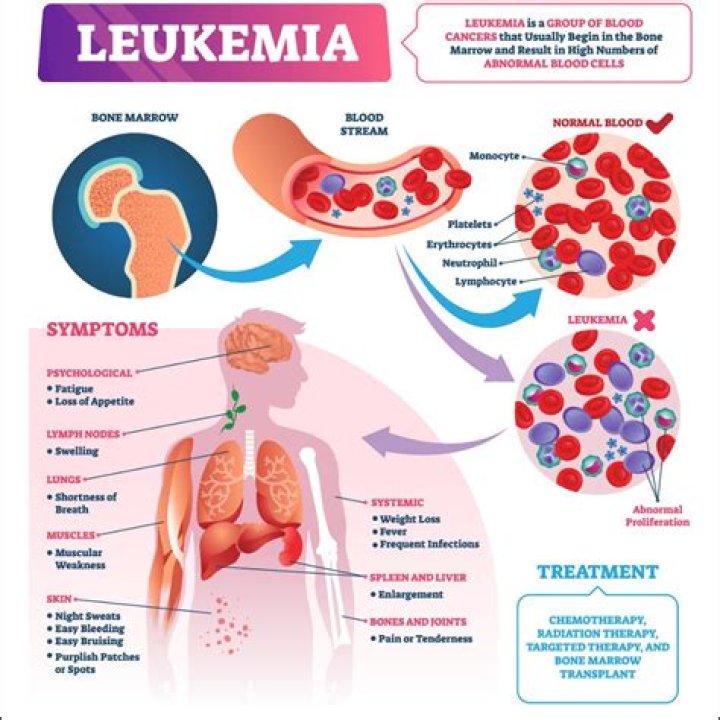 Do leukemia patients need bone marrow?