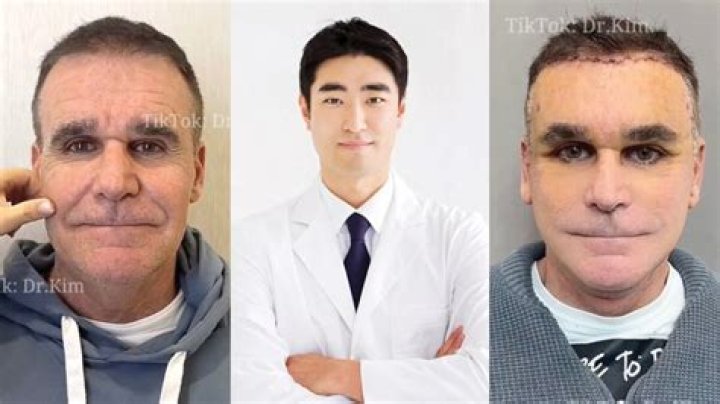 Why would I be referred to a plastic surgeon? - The Daily Insight